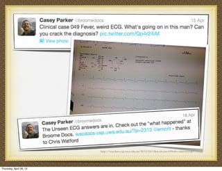 http://wacdocs.csp.uwa.edu.au/2012/04/clinical-case-049-the-unseen-ecg/




Thursday, April 26, 12
 