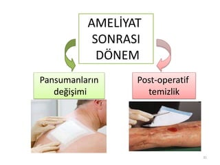 Pansumanların
değişimi
Post-operatif
temizlik
AMELİYAT
SONRASI
DÖNEM
31
 