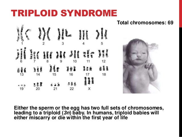 Triploidy X Syndrome Diet