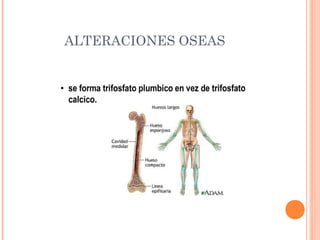 ALTERACIONES OSEAS
 