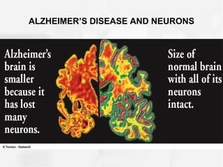 ALZHEIMER’S DISEASE AND NEURONS
 