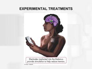 EXPERIMENTAL TREATMENTS
 