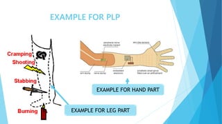 EXAMPLE FOR PLP
EXAMPLE FOR LEG PART
EXAMPLE FOR HAND PART
 