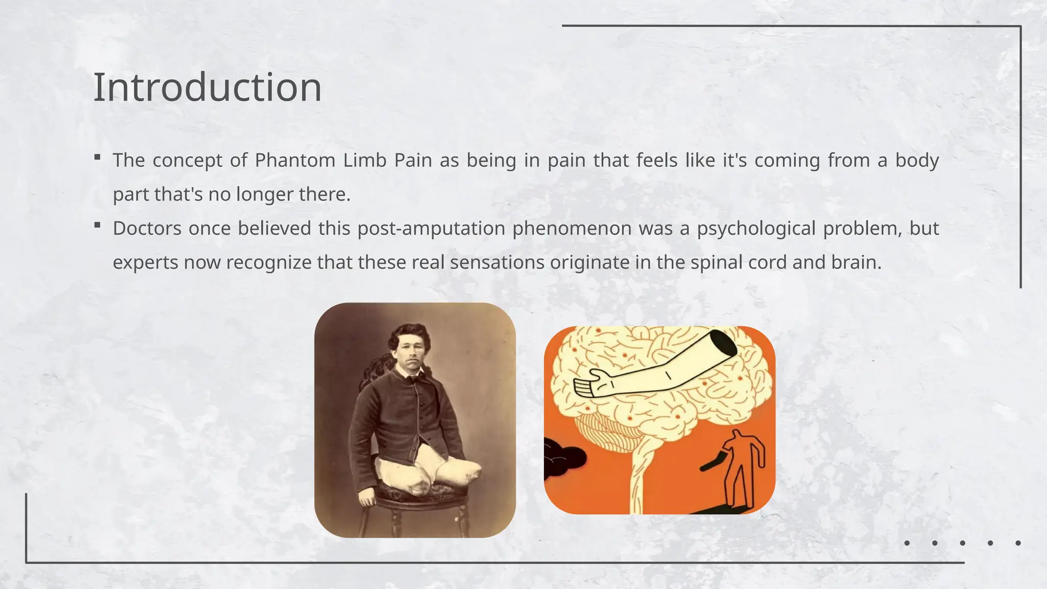 View of Tinnitus - Symptoms and causes - Mayo Clinic