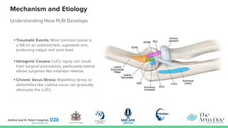 Posterolateral elbow instability for professionals | PDF