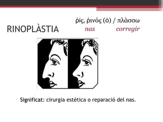RINOPLÀSTIA

ῥίς, ῥινός (ὁ) / πλάσσω
nas
corregir

Significat: cirurgia estètica o reparació del nas.

 
