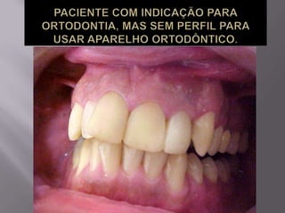 Plástica dental