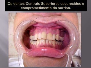 Plástica dental