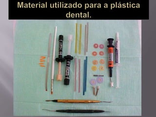 Plástica dental