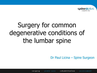 Surgery for common
degenerative conditions of
the lumbar spine
Dr Paul Licina – Spine Surgeon
 