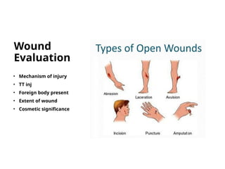 Wound
Evaluation
• Mechanism of injury
• TT inj
• Foreign body present
• Extent of wound
• Cosmetic significance
 