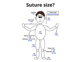Suture size?
 