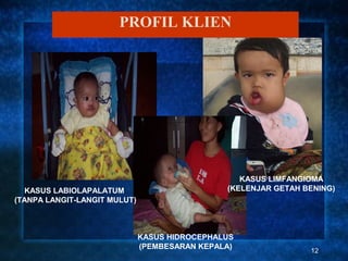 PROFIL KLIEN




                                                  KASUS LIMFANGIOMA
  KASUS LABIOLAPALATUM                         (KELENJAR GETAH BENING)
(TANPA LANGIT-LANGIT MULUT)



                              KASUS HIDROCEPHALUS
                              (PEMBESARAN KEPALA)
                                                                12
 