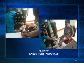 KLIEN ‘F’
KASUS POST- AMPUTASI

                       15
 