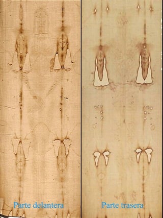 Parte delantera Parte trasera
 