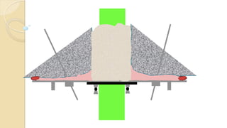 Plugging of Service Hole_Animation | PDF