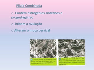o Contêm estrogénios sintéticos e
progestagéneo
o Inibem a ovulação
o Alteram o muco cervical
Pílula Combinada
 