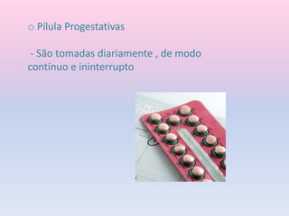 o Pílula Progestativas
- São tomadas diariamente , de modo
contínuo e ininterrupto
 