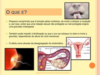 O que é?Pequeno comprimido que é tomado pelas mulheres, de modo a atrasar a ovulação e, por isso, evitar que uma relação sexual não protegida ou mal protegida origine uma gravidez indesejada;Também pode impedir a fertilização ou que o ovo se coloque no útero e inicie a gravidez, dependendo da altura do ciclo menstrual;O efeito corre através da desagregação do endométrio.Agrupamento de Escolas da Charneca de Caparica