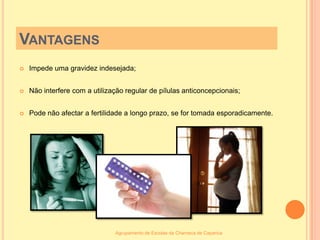 VantagensImpede uma gravidez indesejada;