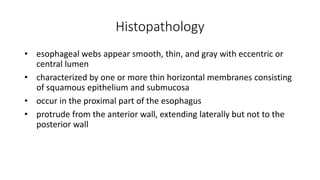 Histopathology
• esophageal webs appear smooth, thin, and gray with eccentric or
central lumen
• characterized by one or more thin horizontal membranes consisting
of squamous epithelium and submucosa
• occur in the proximal part of the esophagus
• protrude from the anterior wall, extending laterally but not to the
posterior wall
 