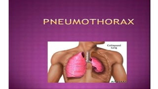 Plural effusion, PE & lung abscess, pneumothorax_014402.pptx
