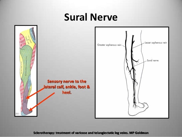 The Important Nerves During Venous Ablation