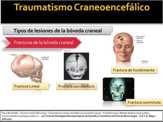 TraumatismoCraneoencefálico
Tipos de lesiones de la bóveda craneal
Fracturas de la bóveda craneal
Fractura Lineal Fractura con diastasis
Fractura conminuta
Fractura de hundimiento
Parra Bernal MC.; Gómez Lomelí ZM (2009),“Traumatismocráneo-encefálico en el adulto mayor”, El adulto mayor: Mirada desde la salud publica,
Universidadde Guadalajara,México… 1er Curso de Patologías Neuroquirúrgicas de Guardia y Consultorio Servicio de Neurocirugía – H.E.C.A.Mayo –
Julio 2013
 