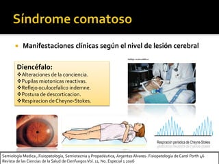  Manifestaciones clínicas según el nivel de lesión cerebral
Diencéfalo:
Alteraciones de la conciencia.
Pupilas miotonicas reactivas.
Reflejo oculocefalico indemne.
Postura de descorticacion.
Respiracion de Cheyne-Stokes.
Semiología Medica , Fisiopatología, Semiotecnia y Propedéutica, Argentes Alvares- Fisiopatología de Carol Porth 46
Revista de las Ciencias de la Salud de Cienfuegos Vol. 11, No. Especial 1 2006
 