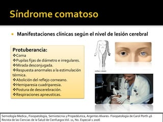 Semiología Medica , Fisiopatología, Semiotecnia y Propedéutica, Argentes Alvares- Fisiopatología de Carol Porth 46
Revista de las Ciencias de la Salud de Cienfuegos Vol. 11, No. Especial 1 2006
 Manifestaciones clínicas según el nivel de lesión cerebral
Protuberancia:
Coma
Pupilas fijas de diámetro e irregulares.
Mirada desconjugada.
Respuesta anormales a la estimulación
térmica.
Abolición del reflejo corneano.
Hemiparesia cuadriparesia.
Postura de descerebración.
Respiraciones apneusticas.
 