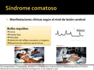 Semiología Medica , Fisiopatología, Semiotecnia y Propedéutica, Argentes Alvares- Fisiopatología de Carol Porth 46
Revista de las Ciencias de la Salud de Cienfuegos Vol. 11, No. Especial 1 2006
 Manifestaciones clínicas según el nivel de lesión cerebral
Bulbo raquídeo:
Coma
Pupilas fijas.
Flaccidez.
Abolición del reflejo nauseoso y tusigeno.
Respiraciones atáxicas apneusticas.
 