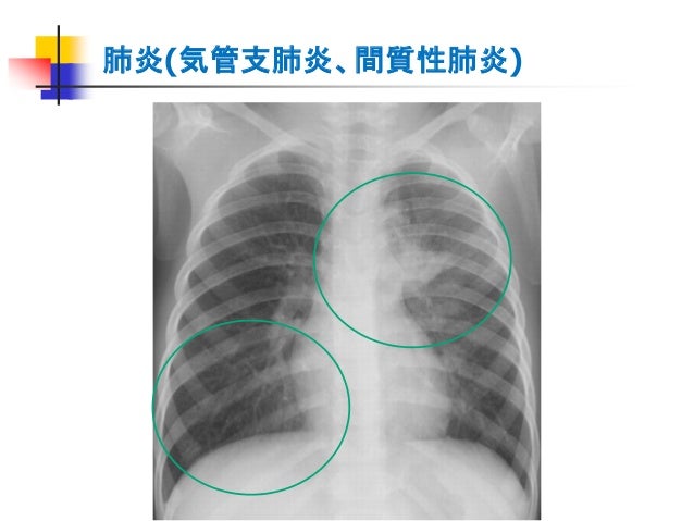 Pm34 胸部x線写真の読影 Pm34 胸部x線写真の読影