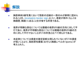 Pm34 胸部x線写真の読影③ | PDF