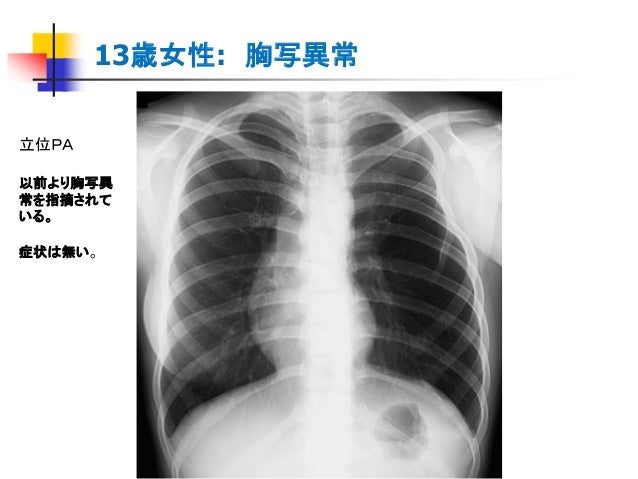 Pm34 胸部ｘ線写真の読影