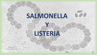 SALMONELLA
Y
LISTERIA
 