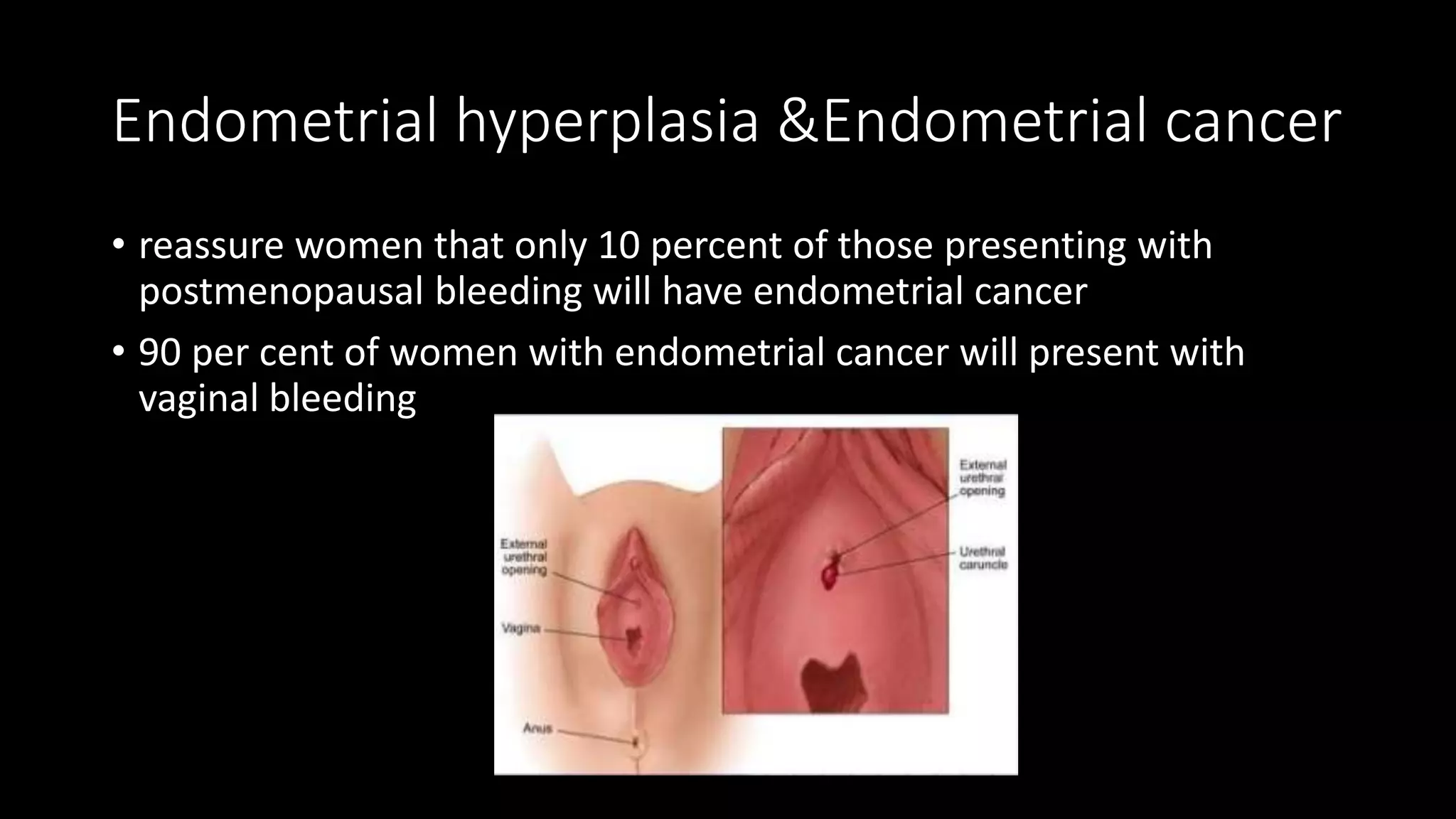 Endometrial hyperplasia &Endometrial cancer
• reassure women that only 10 percent of those presenting with
postmenopausal bleeding will have endometrial cancer
• 90 per cent of women with endometrial cancer will present with
vaginal bleeding
 