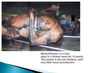 Mummification in a man
dead in a locked room for 10 weeks.
The corpse is dry and leathery, with
very little moist putrefaction.
 