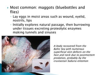  Most common: maggots (bluebottles and
flies)
◦ Lay eggs in moist areas such as wound, eyelid,
nostrils, lips
◦ Initially explores natural passage, then burrowing
under tissues excreting proteolytic enzymes
making tunnels and sinuses
A body recovered from the
Baltic Sea with numerous
superficial skin defects on the
face and neck due to postmortem
predation, probably by the
crustacean Saduria entomon
 