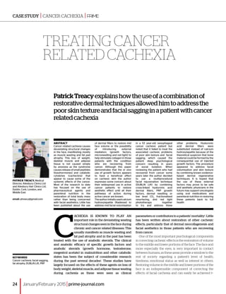 Treating the facial wasting of cancer related cachexia | PDF