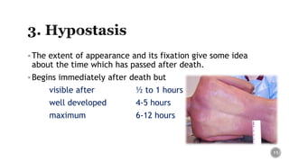 The extent of appearance and its fixation give some idea
about the time which has passed after death.
Begins immediately after death but
visible after ½ to 1 hours
well developed 4-5 hours
maximum 6-12 hours
11
 