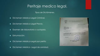  Dictamen Médico-Legal Criminal.
 Dictamen Médico-Legal Previo.
 Examen de laboratorio o autopsia.
 Exhumación.
 Dictamen Médico-Legal por perito
 Dictamen Médico- Legal de sanidad.
Peritaje medico legal.
Tipos de Dictámenes.
 