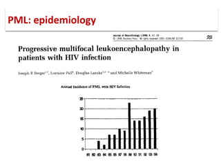 PML: epidemiology
 
