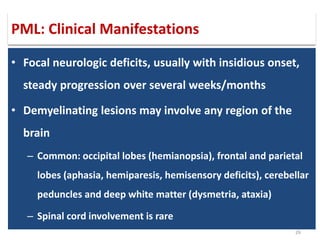 26
• Focal neurologic deficits, usually with insidious onset,
steady progression over several weeks/months
• Demyelinating lesions may involve any region of the
brain
– Common: occipital lobes (hemianopsia), frontal and parietal
lobes (aphasia, hemiparesis, hemisensory deficits), cerebellar
peduncles and deep white matter (dysmetria, ataxia)
– Spinal cord involvement is rare
PML: Clinical Manifestations
 