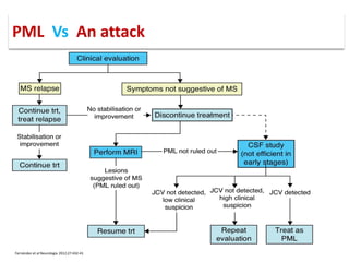 Fernández et al Neurologia 2012;27:432-41
PML Vs An attack
 