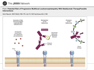 Copyright © 2007 American Medical
Association. All rights reserved.
From: Potential Risk of Progressive Multifocal Leukoencephalopathy With Natalizumab TherapyPossible
Interventions
Arch Neurol. 2007;64(2):169-176. doi:10.1001/archneur.64.2.169
 