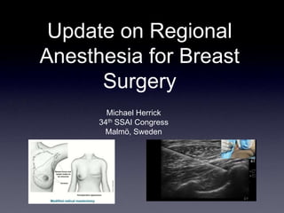 Update on Regional
Anesthesia for Breast
Surgery
Michael Herrick
34th SSAI Congress
Malmö, Sweden
 