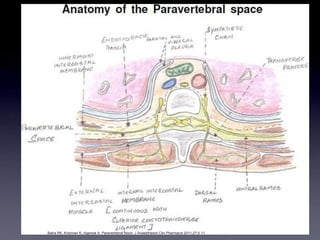 Batra RK, Krishnan K, Agarwal A. Paravertebral block. J Anaesthesiol Clin Pharmacol 2011;27:5-11
]
Batra RK, Krishnan K, A...