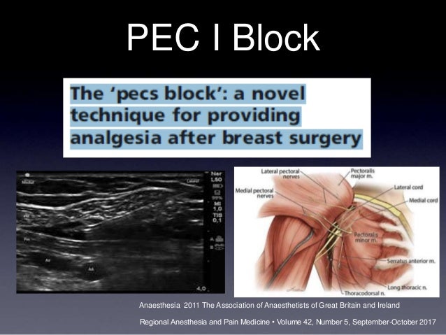 pec block