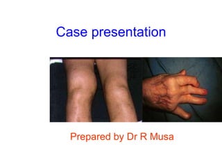 Case presentation Prepared by Dr R Musa 