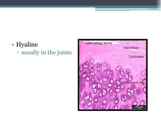 • Hyaline
▫ usually in the joints
 